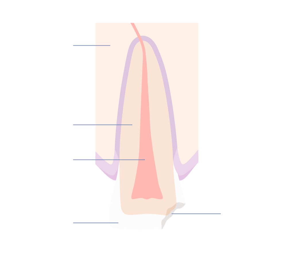 Dental trauma showing a chipped crown